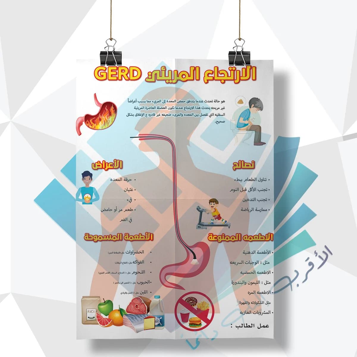 لوحة مدرسية عن الارتجاع المريئي